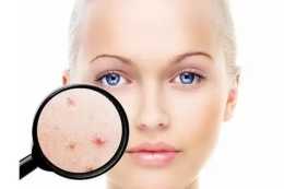 精準油痘肌問題所在：伊膚泉祛痘聯合問題肌研究所，逆轉健康皮