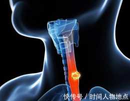 北京古樓疑難病研究院劉長城：食管癌手術後如何來護理呢？