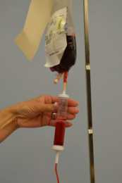 「輸血」是一件很困難的事，醫生用了300年才成功